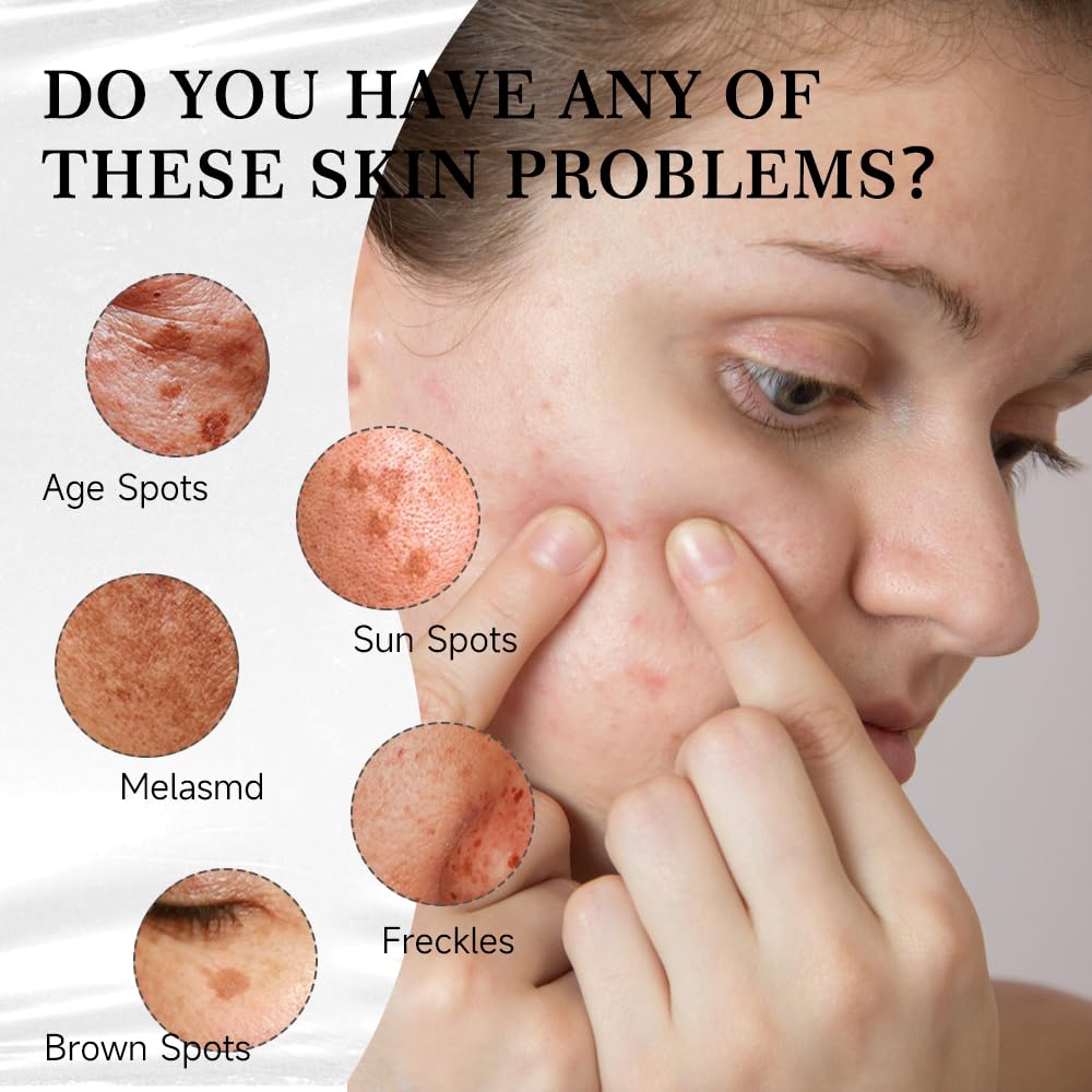 Radiant Skin Dark Spot Corrector™