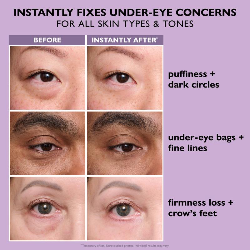 Instant Eye Tightening Cream™