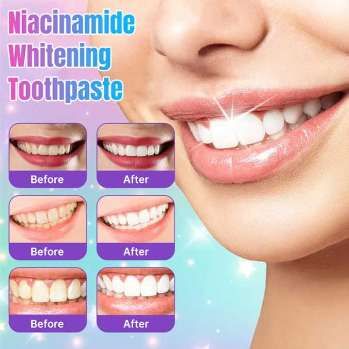 Herbal Whitening Toothpaste for Families™
