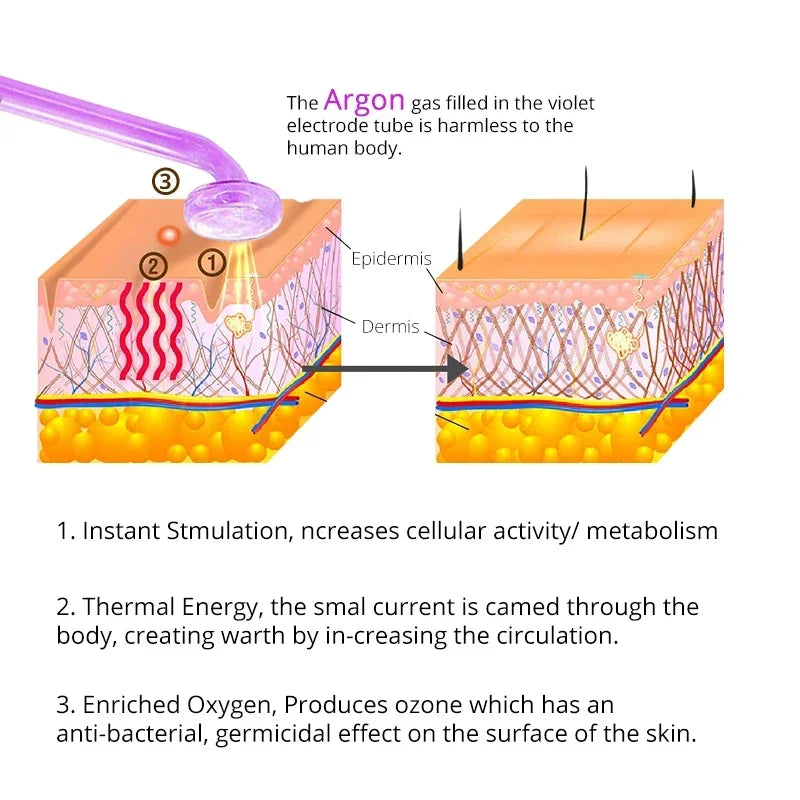Radiant Skin High-Frequency Therapy™