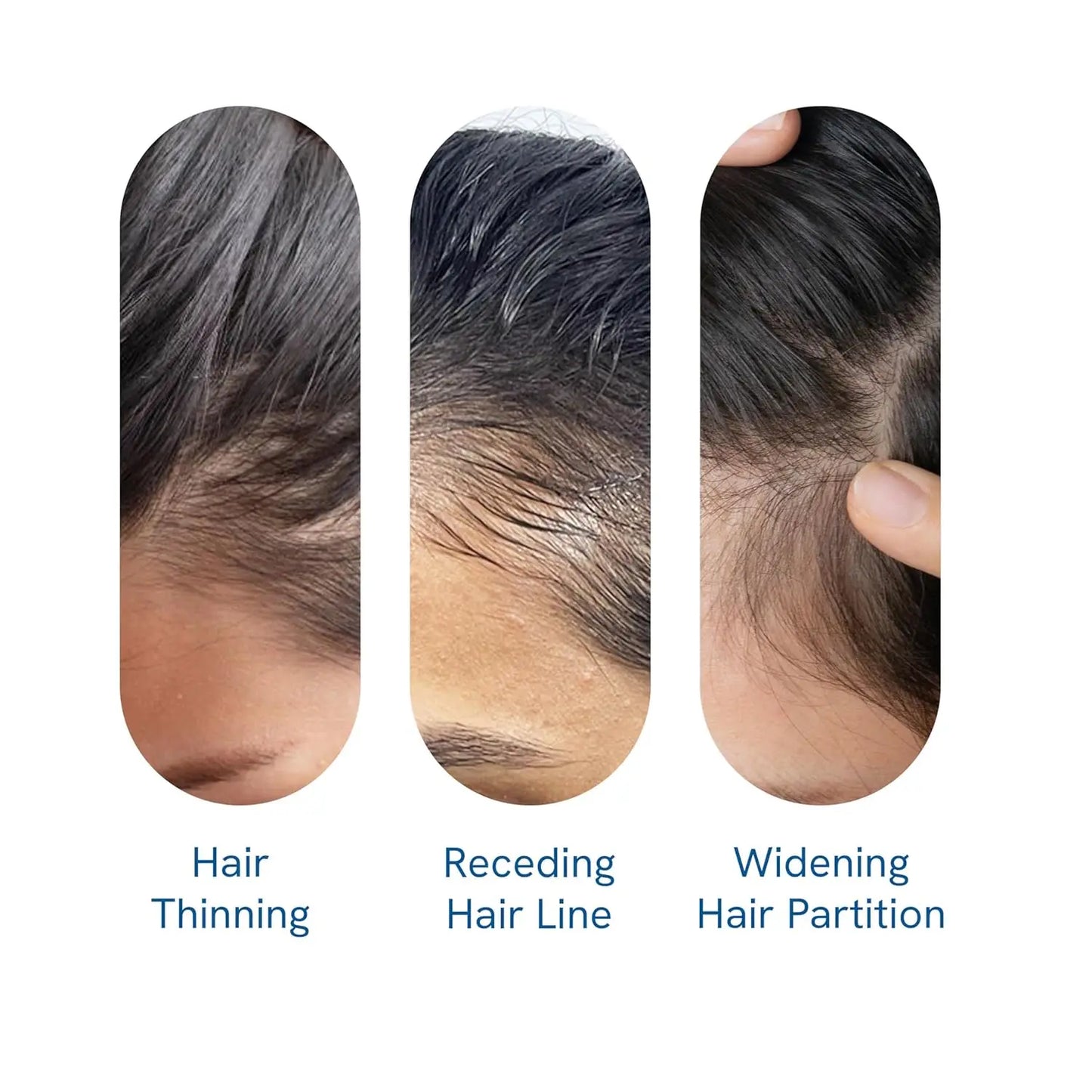 Rosemary Revive Hair Growth Serum™