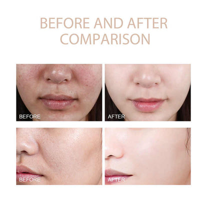 Velaré Purifying Gel™
