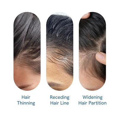 Rosemary Revive Hair Growth Serum™
